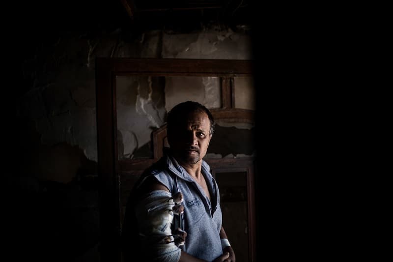 A portrait of 51 year old Shamel. He is from West Mosul and was injured on March 7th by a helicopter fire. Photo: Diego Ibarra Sánchez/MEMO