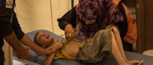 A young syrian from Raqqa is having his stitches removed at the MSF clinic in Aïn Issa Displaced Camp. Photo: Chris Huby