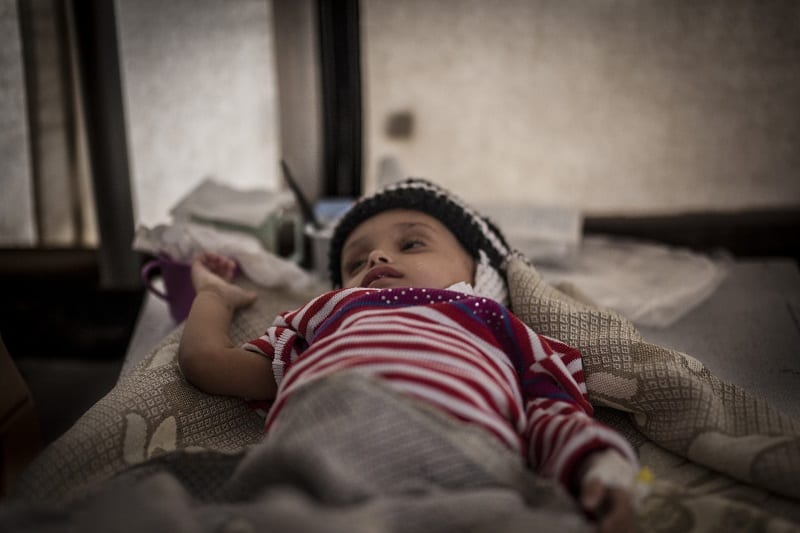 A child lying on one of the bed in MSF cholera treatment centre at the Al Thawra hospital in Qaeda / Ibb governorate. Photo: MSF