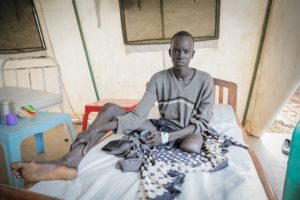 Banywich Bone, 18, had his leg amputated at Agok hospital following a severe infection after being bitten by a snake. Photo: Pierre-Yves Bernard/MSF