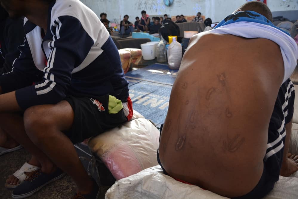 A man shows his scars and wounds inflicted during his captivity at the hands of traffickers. Libya, June 2019.
© JÉRÔME TUBIANA/MSF