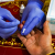 MSF launches a large hepatitis C “test and treat” campaign amid critical lack of treatment options
