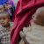 Measles outbreak in Baidoa, Somalia still threating children's lives