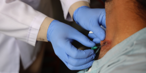 World NTDs Day: MSF calls for sustainable access to treatment for cutaneous leishmaniasis in Pakistan